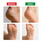 M.KAASA FOOT HEAL CREAM